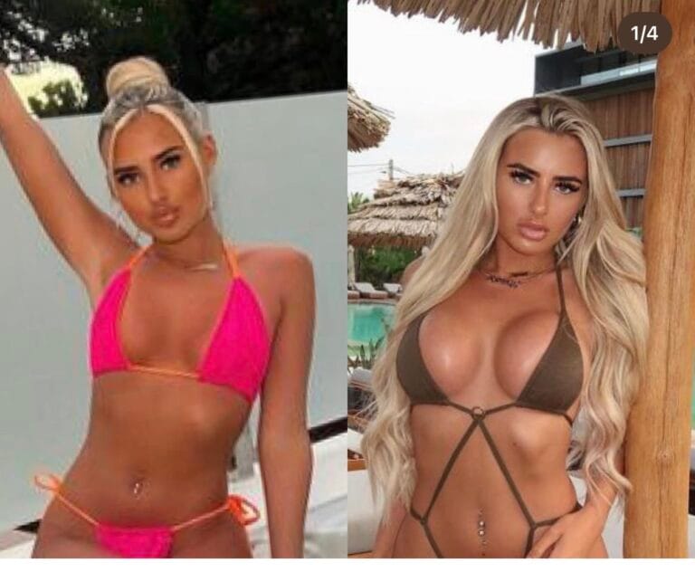 Read more about the article Understanding Breast Reduction Surgery