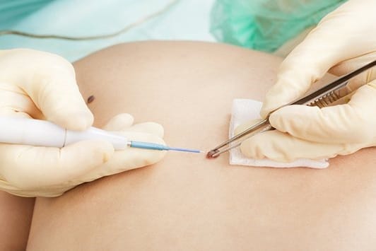Read more about the article Skin Surgery London: What It Is and How It Can Help Restore Your Confidence